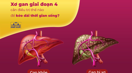 Xơ gan giai đoạn 4 cần điều trị thế nào để kéo dài thời gian sống?