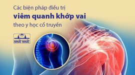 Các biện pháp điều trị viêm quanh khớp vai theo y học cổ truyền 
