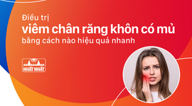 Điều trị viêm chân răng khôn có mủ bằng cách nào hiệu quả nhanh?