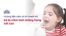 Hướng dẫn cách xử trí nhanh khi bé bị viêm loét miệng họng sốt cao