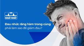 Đau nhức răng hàm trong cùng phải làm sao để giảm đau?