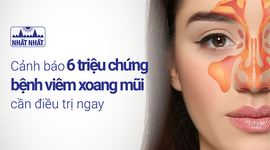 Cảnh báo 6 triệu chứng bệnh viêm xoang mũi cần điều trị ngay