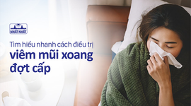 Tìm hiểu nhanh cách điều trị viêm mũi xoang đợt cấp