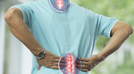 KẾT HỢP THẾ MẠNH THUỐC ĐÔNG Y-TÂY Y TRONG ĐIỀU TRỊ THOÁI HÓA CỘT SỐNG