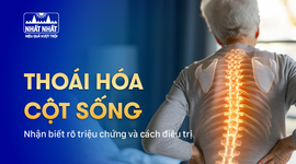 Thoái hóa cột sống: Nhận biết rõ triệu chứng và cách điều trị