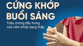 Cứng khớp buổi sáng – Triệu chứng đặc trưng của viêm khớp dạng thấp
