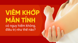 Viêm khớp mãn tính có nguy hiểm không, điều trị như thế nào?