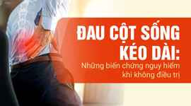Đau cột sống kéo dài: Những biến chứng nguy hiểm khi không điều trị