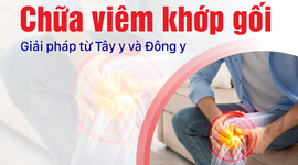 Chữa viêm khớp gối: Giải pháp từ Tây y và Đông y