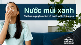 Nước mũi xanh: Vạch rõ nguyên nhân và cách xử trí hiệu quả
