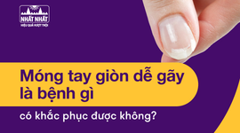 Giải đáp: Móng tay giòn dễ gãy là bệnh gì, có khắc phục được không?