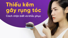 Thiếu kẽm gây rụng tóc – Cách nhận biết và khắc phục