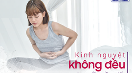 Kinh nguyệt không đều – Những điều cần biết
