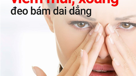 NGĂN NGỪA TÁI PHÁT VIÊM MŨI, XOANG MÃN TÍNH  RẤT KHÓ NHƯNG KHÔNG PHẢI KHÔNG THỂ