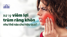 Xử lý khi bị viêm lợi trùm như thế nào cho hiệu quả?