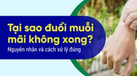 Tại sao đuổi muỗi mãi không xong? Nguyên nhân và cách xử lý đúng