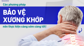 Các phương pháp bảo vệ xương khớp nên thực hiện càng sớm càng tốt!