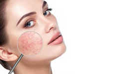Những lưu ý về sữa rửa mặt cho da nhạy cảm bạn không nên bỏ qua