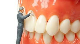 Phòng ngừa cao răng đơn giản hơn bạn nghĩ!