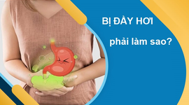 Bị đầy hơi phải làm sao: 10 cách cứu nguy ngay lập tức