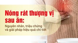 Nóng rát thượng vị sau ăn: Nguyên nhân, triệu chứng và giải pháp