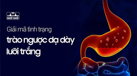 Giải mã tình trạng trào ngược dạ dày lưỡi trắng