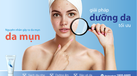 Nguyên nhân gây ra da mụn và giải pháp dưỡng da tối ưu