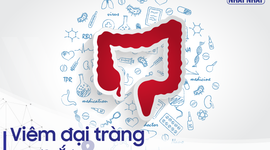 Viêm đại tràng co thắt và những điều cần biết