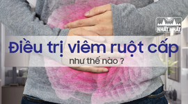 Điều trị viêm ruột cấp như thế nào cho hiệu quả?