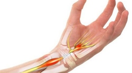 Tổng hợp các nguyên nhân thường gặp khiến bạn bị đau khớp cổ tay 