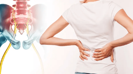 Nhận biết cơn đau thần kinh tọa và hình ảnh chẩn đoán rõ nhất