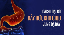 Nguyên nhân và cách loại bỏ chướng bụng đầy hơi dạ dày hiệu quả