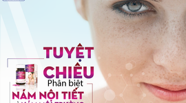 Phân biệt nám nội tiết và nám môi trường