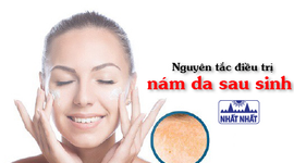 Nguyên tắc điều trị nám da sau sinh cho da sáng mịn màng, không tì vết