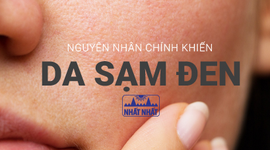 Những nguyên nhân chính khiến da sạm đen, xấu xí