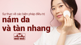 Sự thực về các biện pháp điều trị nám da và tàn nhang 