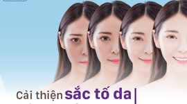Cải thiện sắc tố da không khó như bạn nghĩ