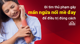 Đi tìm thủ phạm gây mẩn ngứa nổi mề đay để điều trị đúng cách
