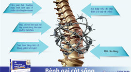 Bệnh gai đốt sống: Nguyên nhân, triệu chứng và điều trị