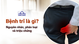 Giải đáp: Bệnh trĩ là gì, nguyên nhân, phân loại và triệu chứng
