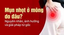 Mụn nhọt ở mông do đâu? Nguyên nhân, ảnh hưởng và giải pháp từ gốc