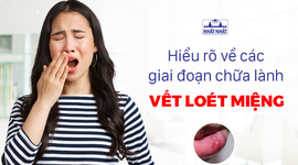 Hiểu rõ về các giai đoạn chữa lành vết loét miệng