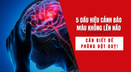 5 dấu hiệu cảnh báo máu không lên não – cần biết để phòng đột quỵ!