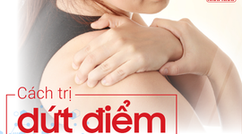 Cách trị dứt điểm đau mỏi vai gáy ở người trẻ tuổi