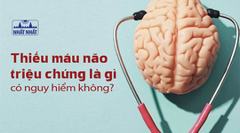 Thiếu máu não triệu chứng là gì? Khi nào nguy hiểm?