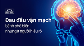 Đau đầu vận mạch – bệnh phổ biến nhưng ít người hiểu rõ
