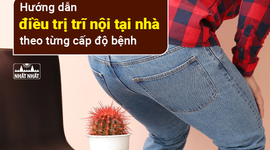 Hướng dẫn điều trị trĩ nội tại nhà theo từng cấp độ bệnh