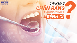 Chảy máu chân răng thường xuyên là bệnh gì?