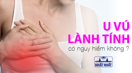 U vú lành tính có nguy hiểm không, khi nào nên mổ?