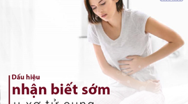 Dấu hiệu nhận biết sớm u xơ tử cung